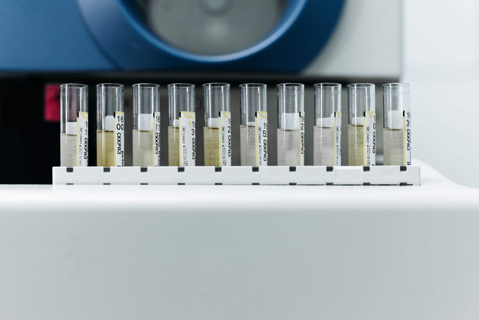 HPLC analysis of research materials in the laboratory